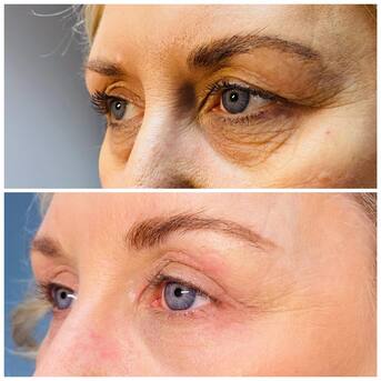 Toronto, Marketing, Facials In Sherwood Park