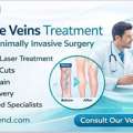 Expert Varicose Veins Surgery With Fast Recovery & Quality Care