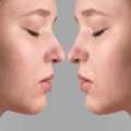 Transform Your Look With Professional Rhinoplasty In Cape Town