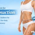 Liposuction Surgery &ndash; Safe & Advanced Fat Removal
