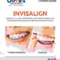 Looking For The Best Invisalign Treatment In Madhapur?