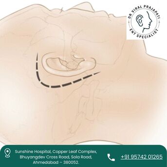 Ahmedabad, Health, Best ENT Doctor For Facial Nerve Decompression In Ahmedabad &ndash; Dr. Viral Prajapati