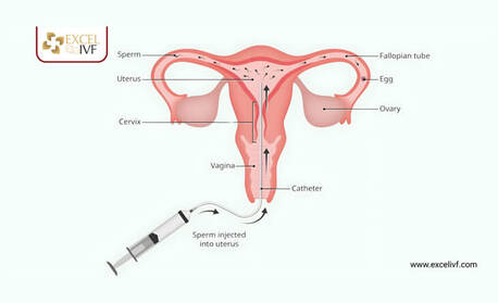 Mumbai, Health, Best Fertility Treatment To Get Pregnant &ndash; Quick Guide