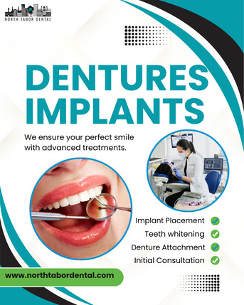 Washington DC, Dental, How Long Do Dentures Implants Last?