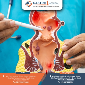 Ahmedabad, Health, Best Fissure Doctor In Ahmedabad For Safe & Effective Care