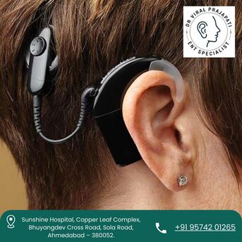 Ahmedabad, Health, Advanced Cochlear Implant Surgeon In Ahmedabad &ndash; Dr. Viral Prajapati
