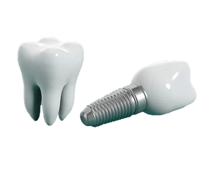 London, Dental, Bristol Prosthodontist | Specialist Tooth Restoration