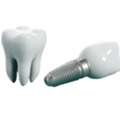 Bristol Prosthodontist | Specialist Tooth Restoration