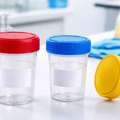 Urine Specimen Collection: Procedure, Methods & Best Practices Guide
