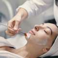 Acid Peel London - Sculpt Wellness