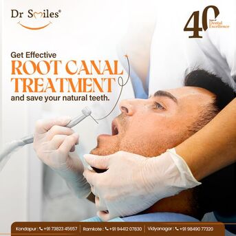 Hyderabad, Dental, Root Canal Treatment In Kondapur - Dr Smiles, Hyderabad