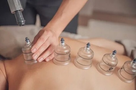 Bangalore, Health, Best Cupping Therapy Service In Bangalore For Pain Relief & Detox