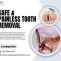 Affordable Tooth Extraction Services Available