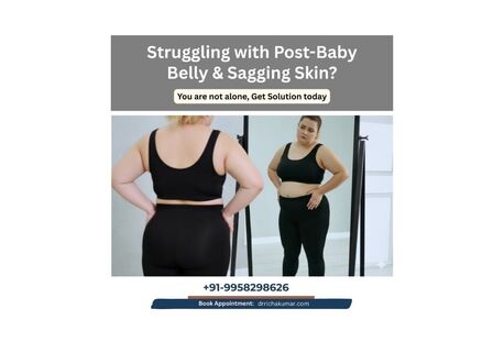New Delhi, Medical, Struggling With Post-Baby Belly & Sagging Skin?
