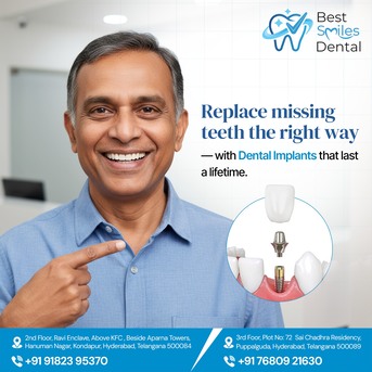 Hyderabad, Dental, Best Dental Implants In Kondapur- Best Smiles Dental, Hyderabad