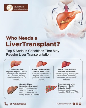 Mumbai, Health, Liver Transplant Needs | Dr. Satyaprakash Ray Choudhury