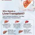 Liver Transplant Needs | Dr. Satyaprakash Ray Choudhury