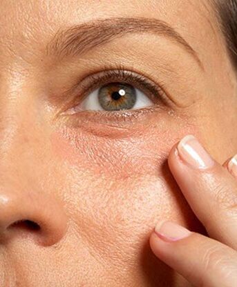 Mumbai, Health & Beauty Items, INR 1000,  Under Eye Cream For Dark Circles And Puffiness