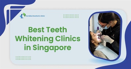 Singapore, Health, Get A Brighter Smile At The Best Teeth Whitening Clinic In Singapore