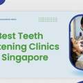 Get A Brighter Smile At The Best Teeth Whitening Clinic In Singapore