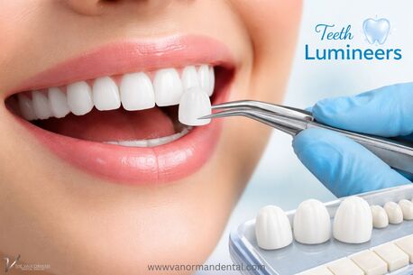 New York, Dental, Instant Smile Makeover With Teeth Lumineers