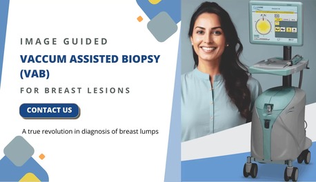 Mumbai, Medical, Advanced Vacuum Assisted Breast Biopsy In India By Picture This