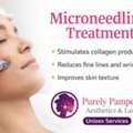 Professional Microneedling In Surrey &ndash; Book Today