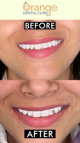 Mumbai, Health, Best Dental Clinic In Chandigarh