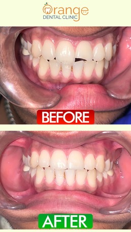 Mumbai, Health, Best Dental Clinic In Chandigarh