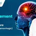 Best Neurologist In Bangalore