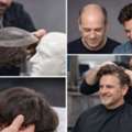 Advanced & Affordable Hair System For Men In Georgia | Hair Clinique Restoration Center