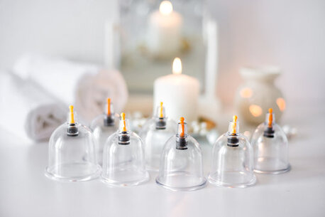 Riyadh, Creative, Hijama  (weight Loss & Colestrol)