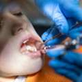Trusted Root Canal Dublin Care | Merrion Square Dental