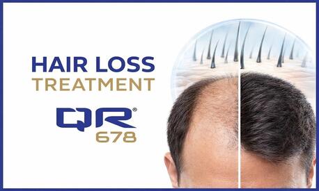 Mumbai, Health, Effective Hair Loss Treatment With Advanced QR678 Formula