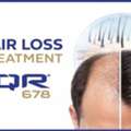 Effective Hair Loss Treatment With Advanced QR678 Formula