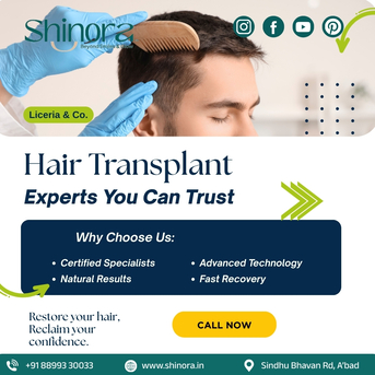 Ahmedabad, Health, Restore Your Hair With Expert Hair Transplant In Ahmedabad