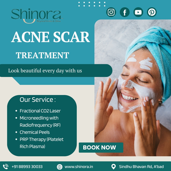 Ahmedabad, Health, Best Acne Scar Treatment In Ahmedabad For Clear, Smooth Skin - Shinora Clinic