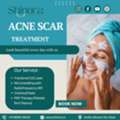 Best Acne Scar Treatment In Ahmedabad For Clear, Smooth Skin - Shinora Clinic