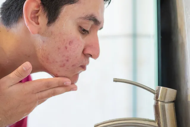 New York, Health, Deep Pore Daily Clean Breakout Cleanser