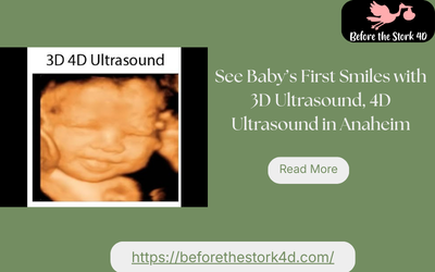 San Diego, Health, See Baby In Detail With 3D Ultrasound, 4D Ultrasound, HD Ultrasound