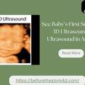 See Baby In Detail With 3D Ultrasound, 4D Ultrasound, HD Ultrasound