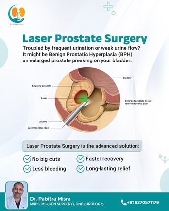 Mumbai, Health, Laser Prostate Surgery | Best Urologist In Bhubaneswar | Dr. Pabitra Misra