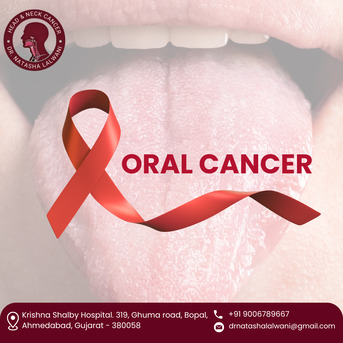 Ahmedabad, Health, Reliable Best Oral Cancer Surgeon In Ahmedabad - Dr Natasha Lalwani