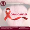 Reliable Best Oral Cancer Surgeon In Ahmedabad - Dr Natasha Lalwani