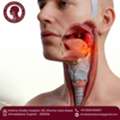 Get Advanced Care From The Best Throat Cancer Surgeon In Ahmedabad