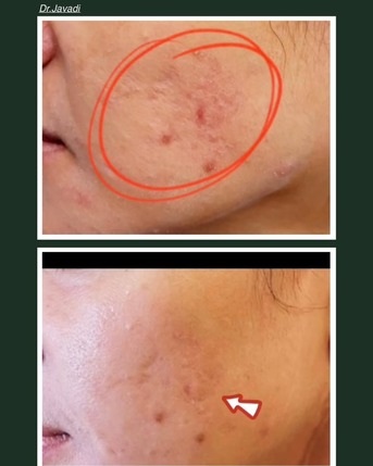 Dubai, Beautician, Skin Symphony Aesthetics Medical Center