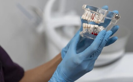 Abu Dhabi, Dental, Dental Bridge Treatment Abu Dhabi - Restore Your Smile With Confidence