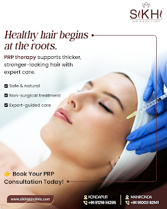 Hyderabad, Health, PRP Treatment In Manikonda  | Sikhi Skin Clinic