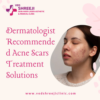Ahmedabad, Health, Dermatologist Recommended Acne Scars Treatment Solutions