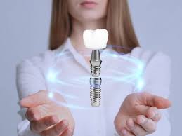 Singapore, Dental, 5 Tips For Maintaining Your Dental Fillings